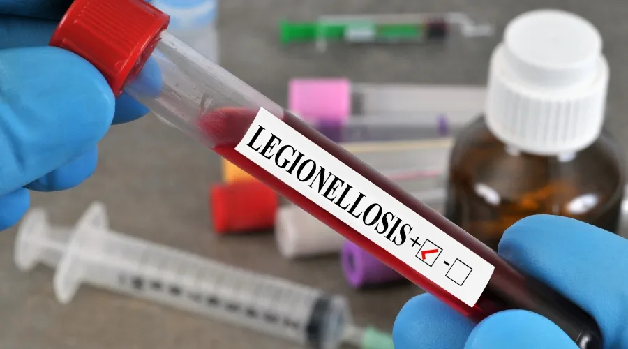 Cómo Evitar la Amenaza de la Legionelosis